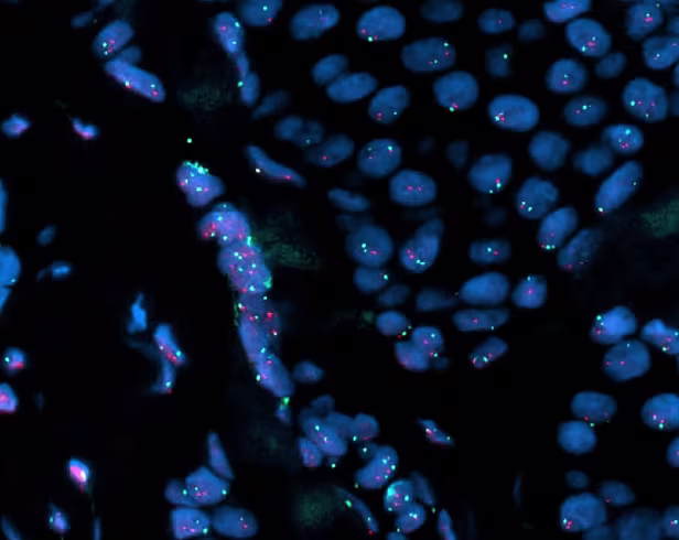 Micropix HER2 fluorescence image