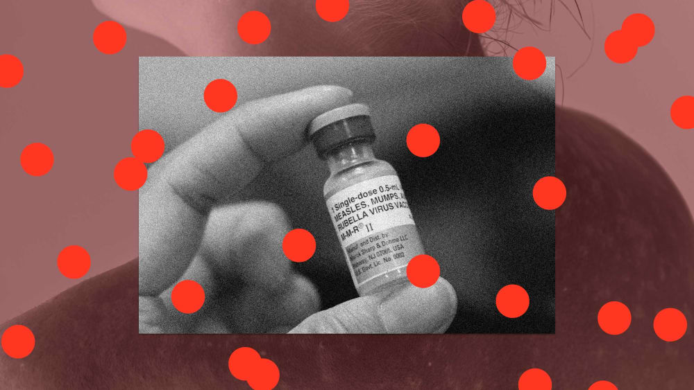 A photo collage showing the measles vaccine overlaying a young woman with the virus