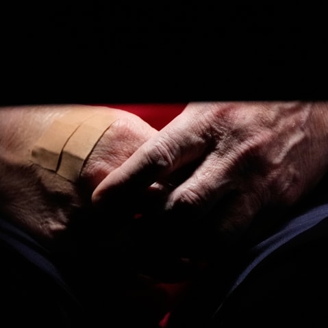 President Trump's right hand is covered with bandaids during a cabinet meeting.