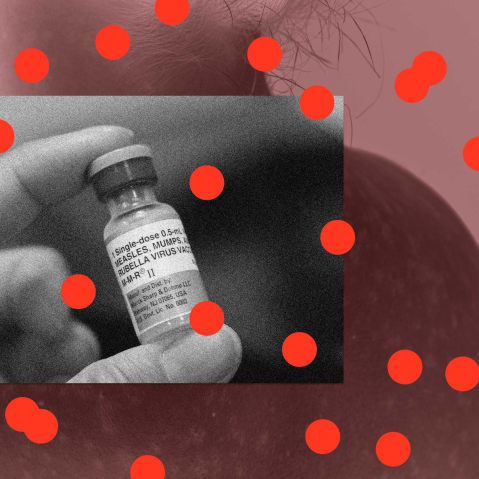 A photo collage showing the measles vaccine overlaying a young woman with the virus