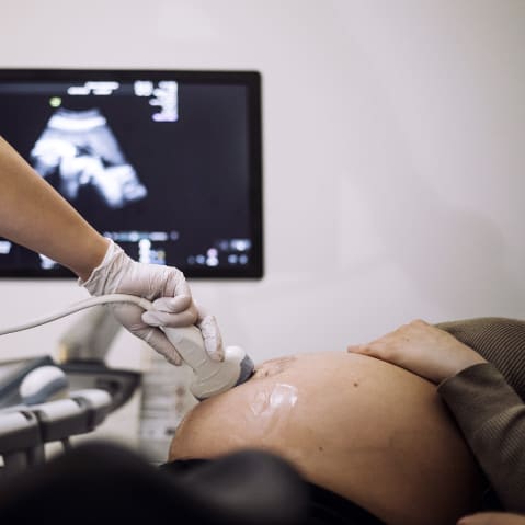 A doctor performs ultrasound on a pregnant patient.