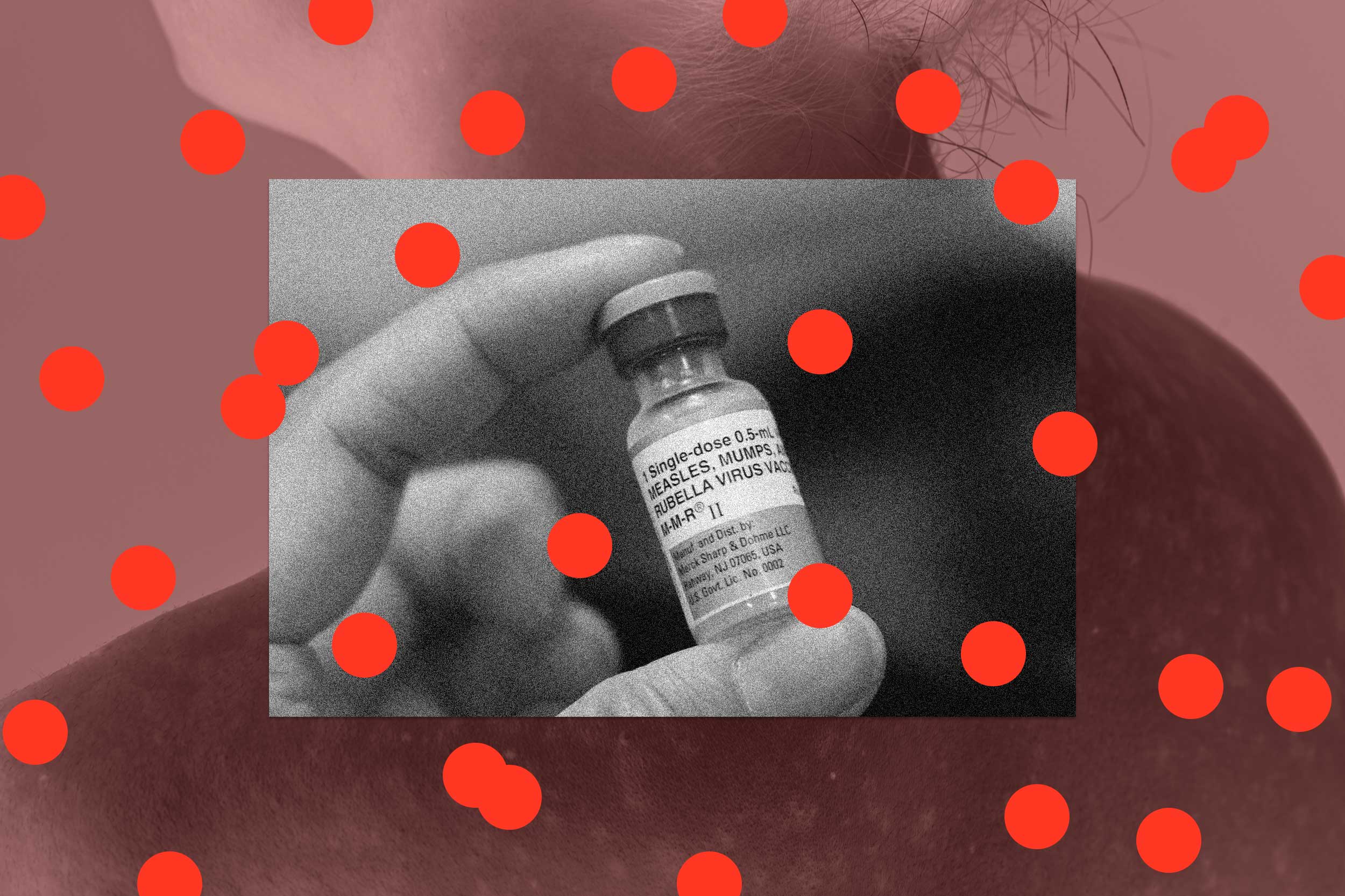 
                            There’s one way to stop the spread of measles — vaccinations