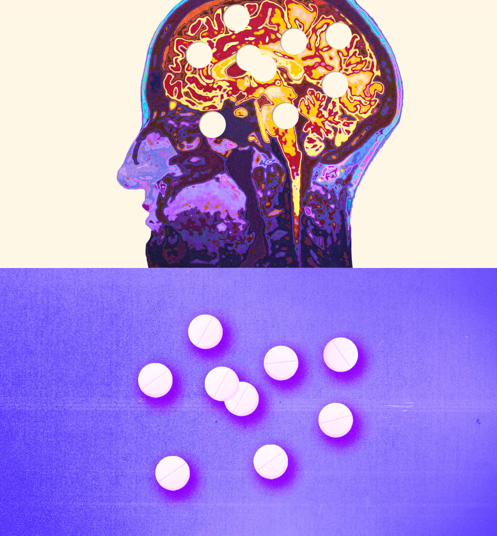 Photo Illustration: An image of a color brain scan and Adderall pills