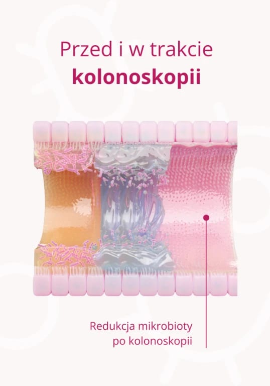 OMNi-BiOTiC® COLONIZE - probiotyk po kolonoskopii