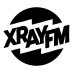 Xray Fm