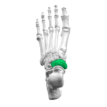 29. Which bone is this?
