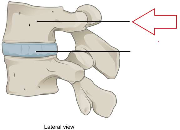 34. Which bone is this?