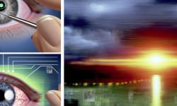 Breakthrough Retinal Implant Restores Sight for People with Age-Related Blindness