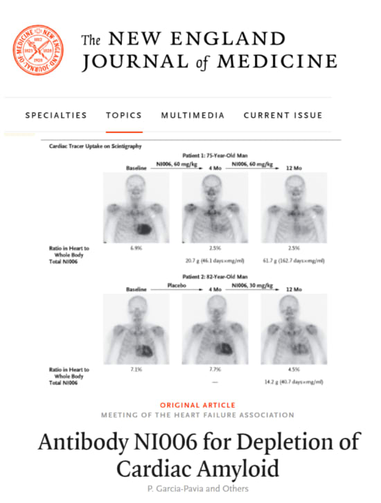 Screenshot of The New England Journal of Medicine webpage showing the article “Antibody NI006 for Depletion of Cardiac Amyloid” with cardiac tracer scan images.