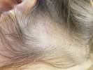 Foto 1 de Tricology Hair Clinic
