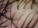 Foto 2 de Tricology Hair Clinic