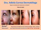 Foto 4 de Dra. Adiela Correa Dermatóloga