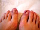 Fotos de Medicated Feet