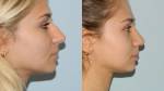 Photos of Dr. Colin Hong Plastic Surgeon