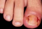 Foto 2 de Medicated Feet