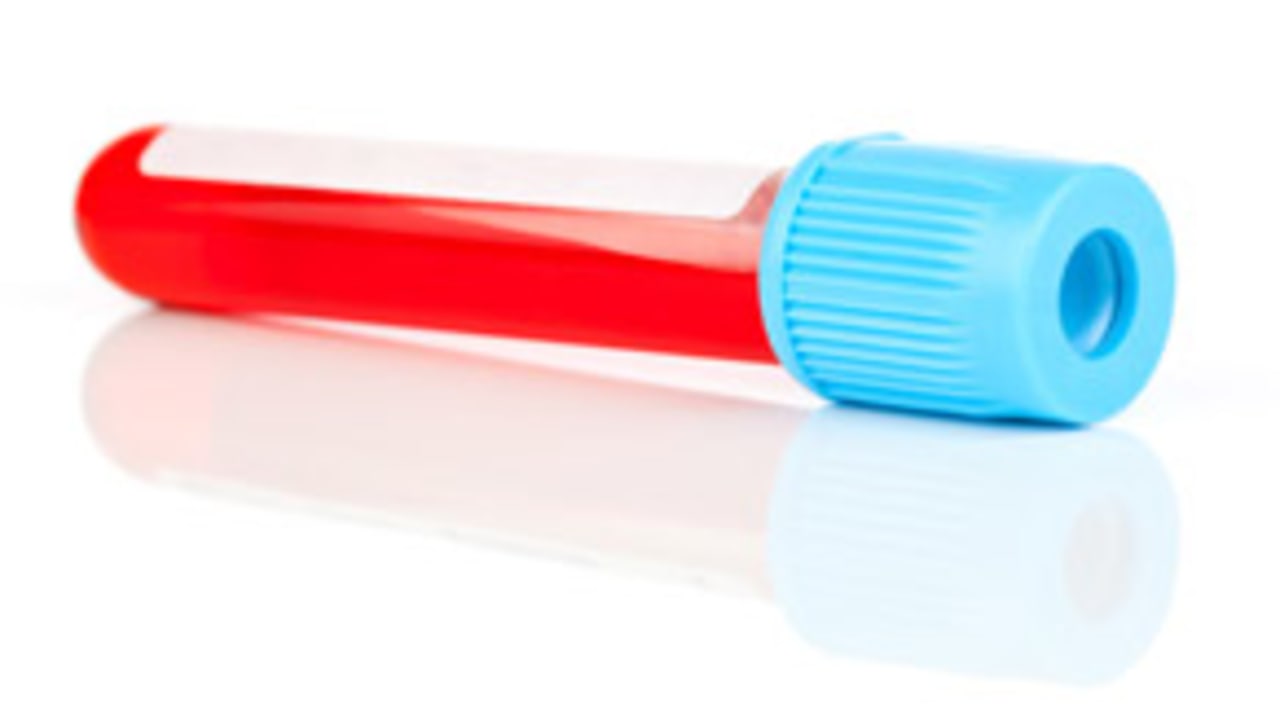 Blood Test130822_Evo