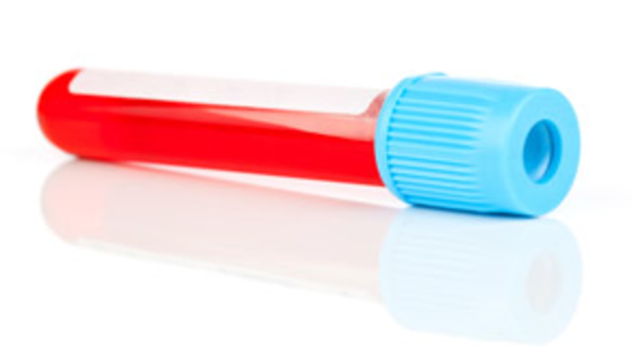 Blood_Test_130813_Evo