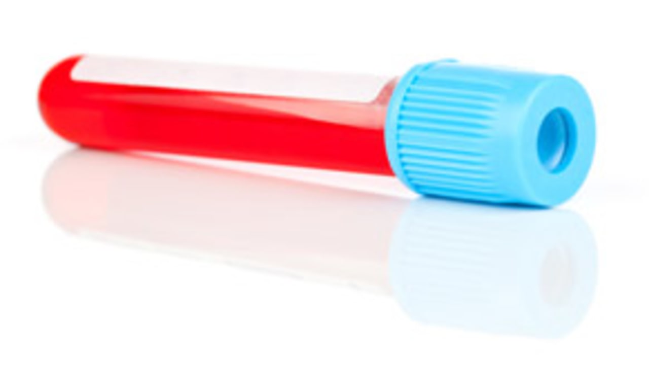 Blood_Test_103827_Evo
