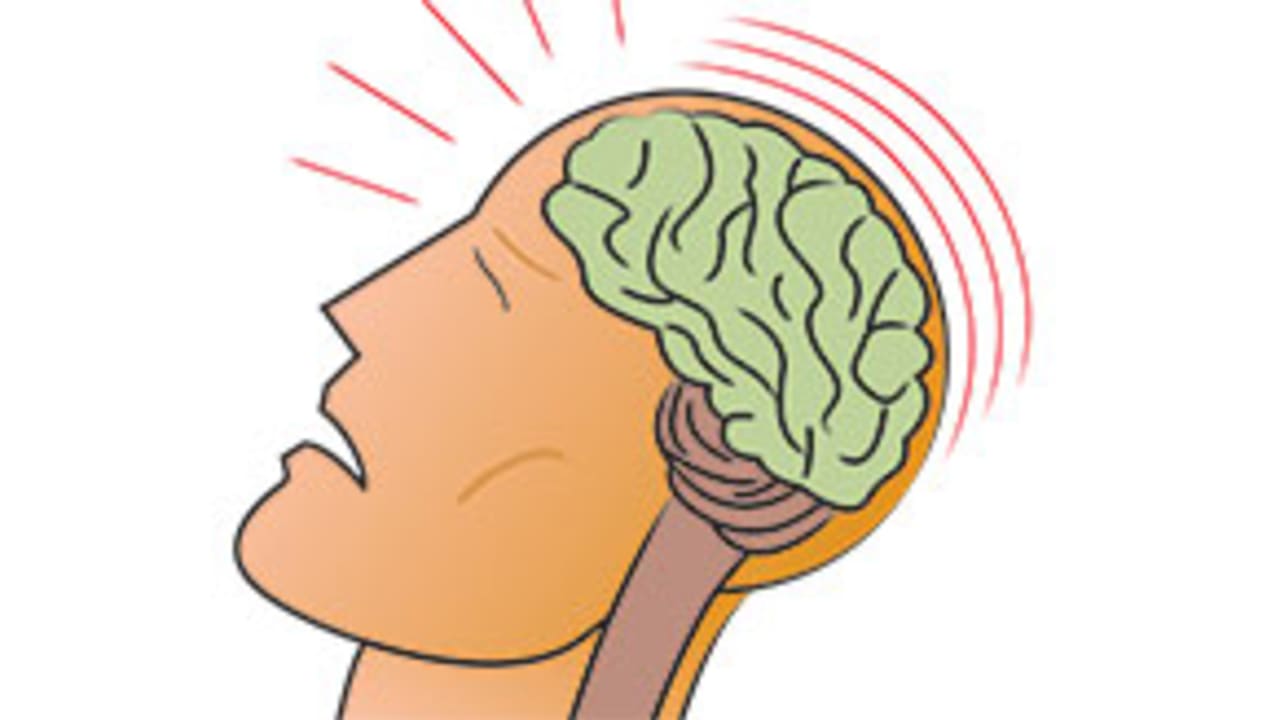 concussion-130821-300.jpg