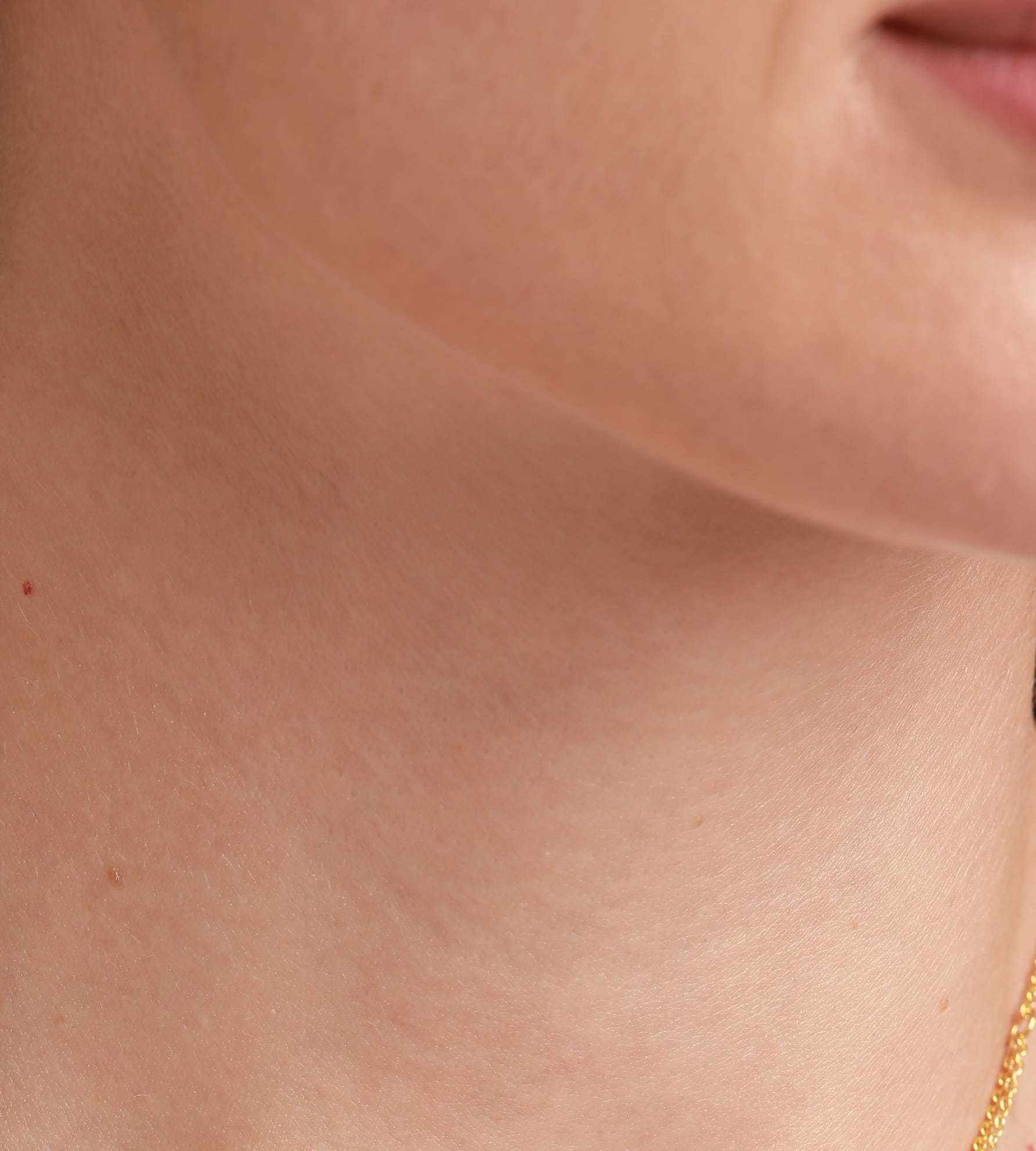 Sparkle Necklace- Cancer view 2