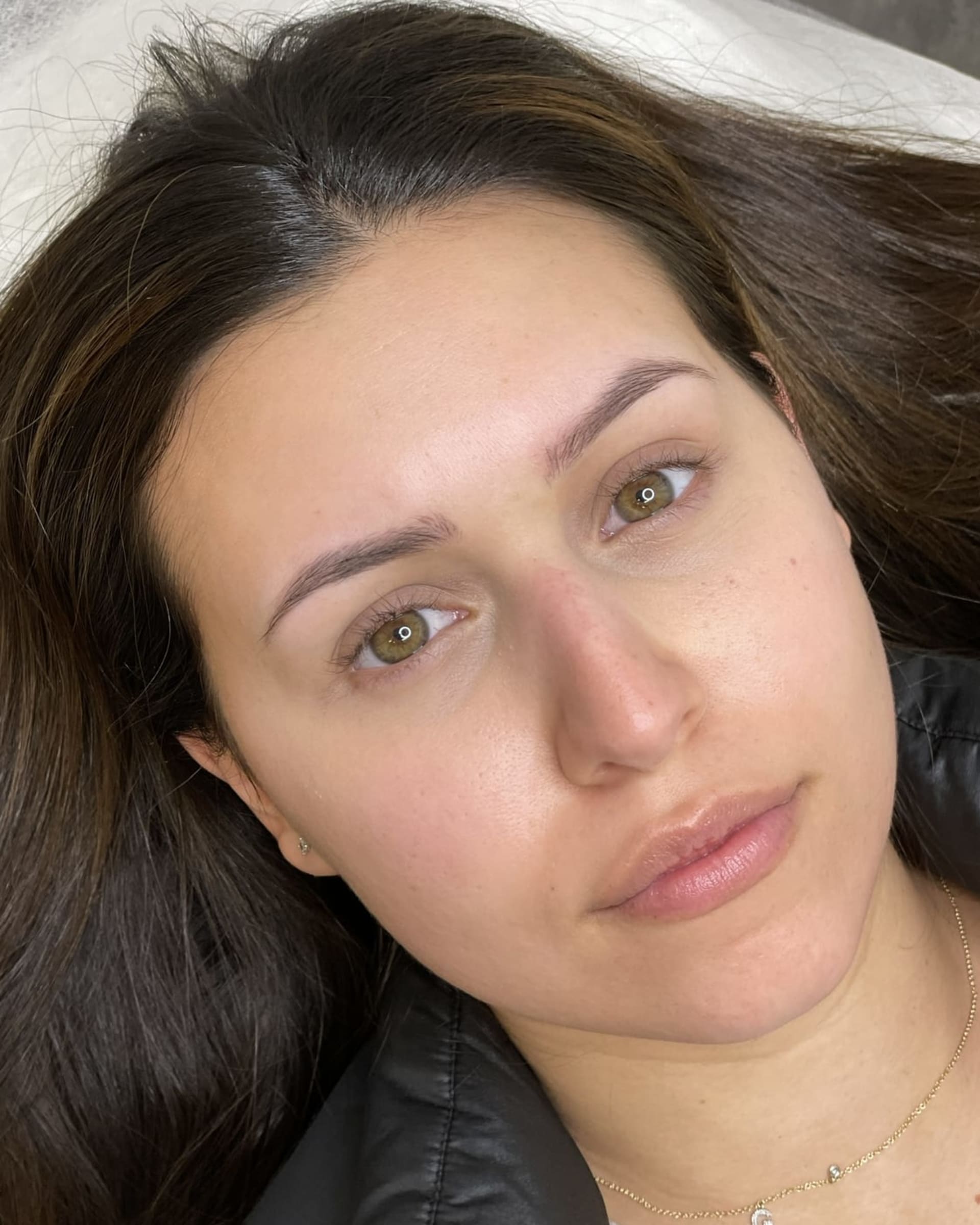 Before - Nina N.