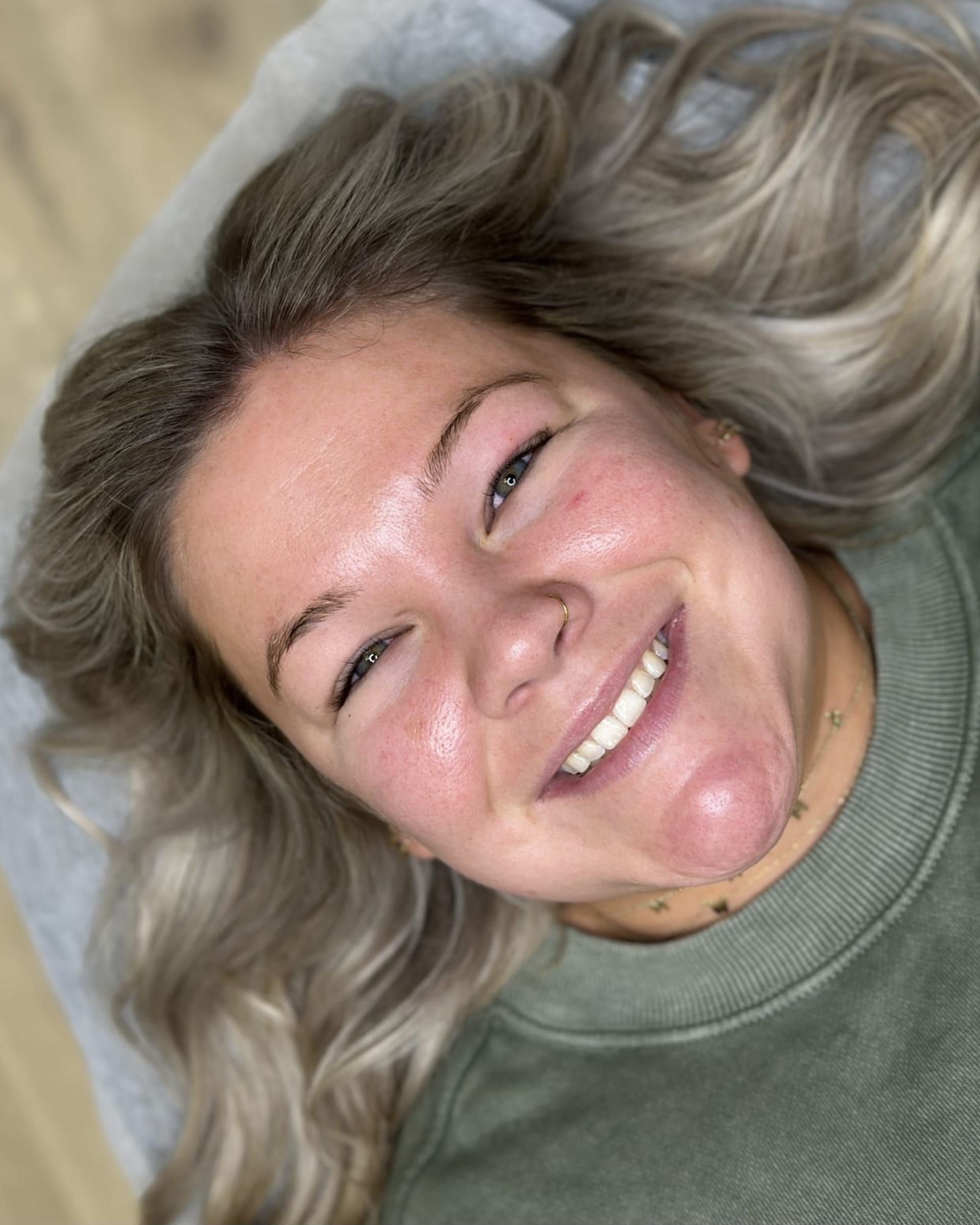 Before - Alexa D.