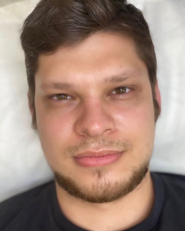 Before microblading - Male transformation