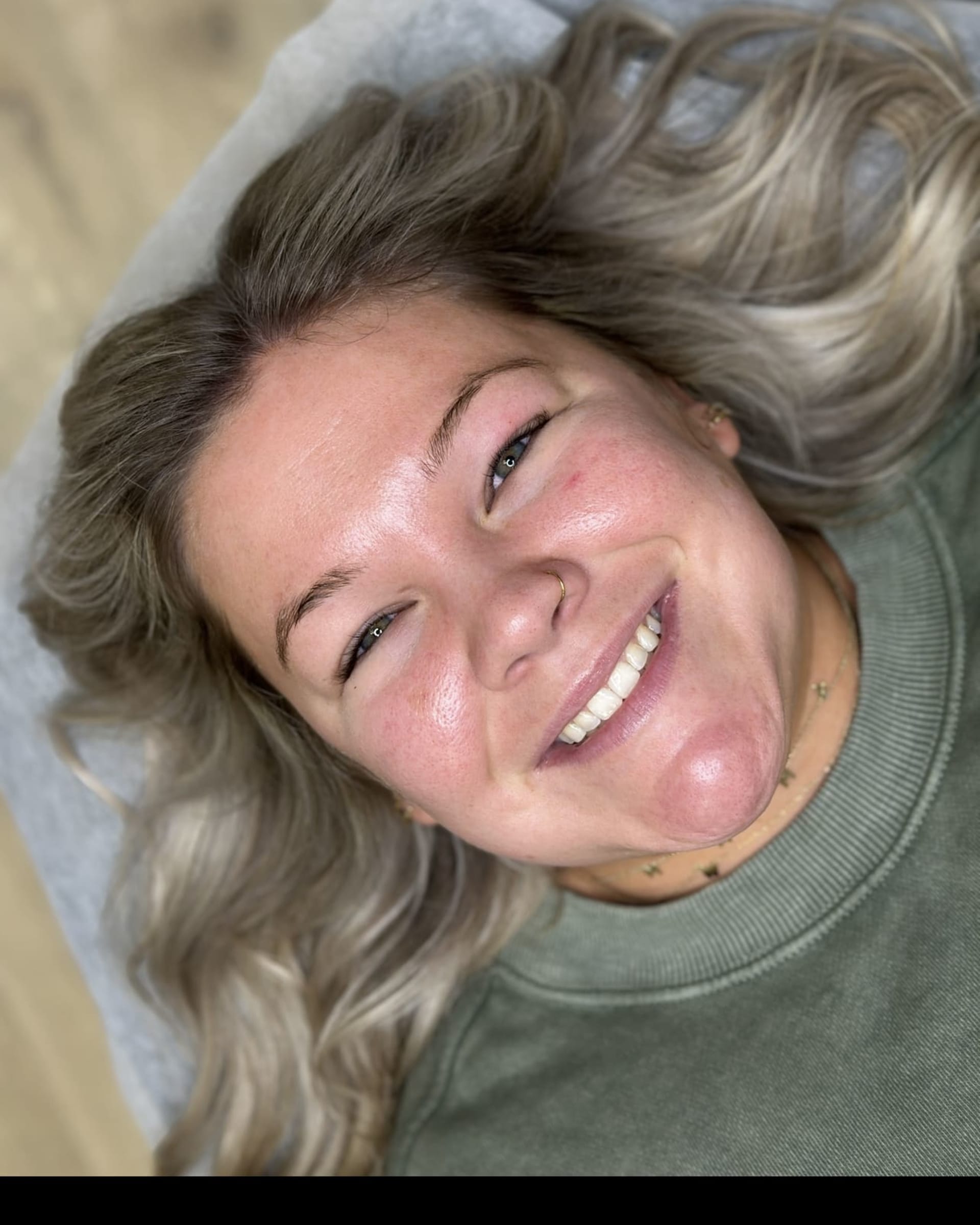 Before - Alexa D.