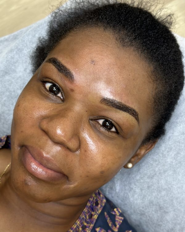 After microblading - Orland Park client