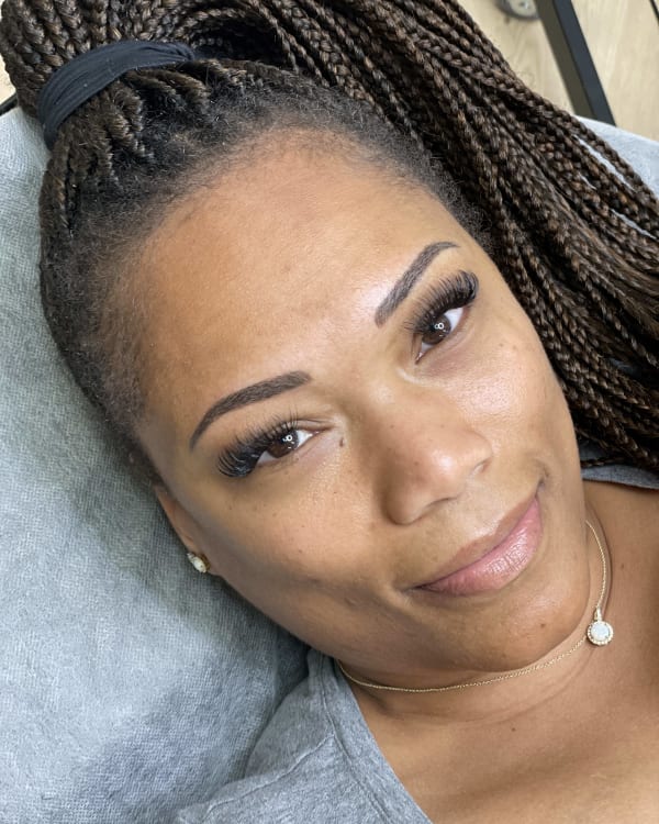 After microblading - Schaumburg client