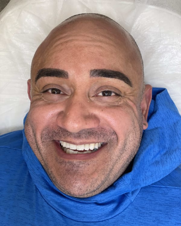 After microblading - Male transformation