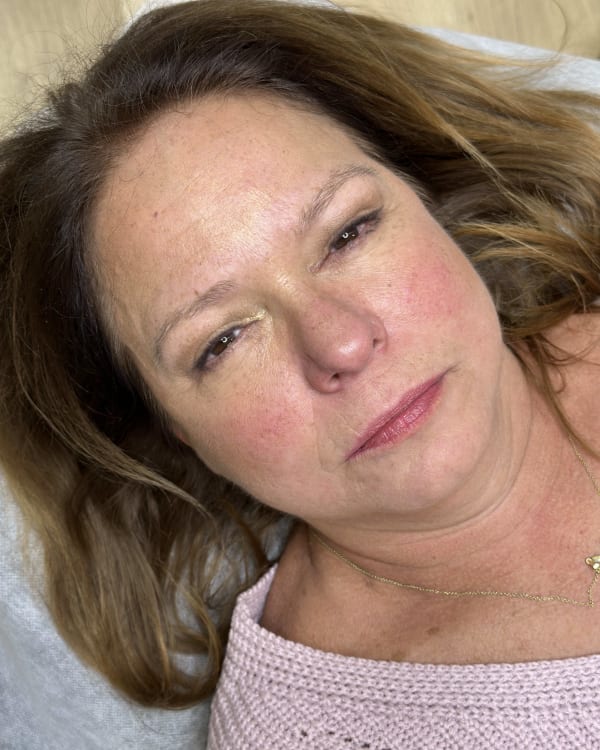Before microblading - Mature transformation