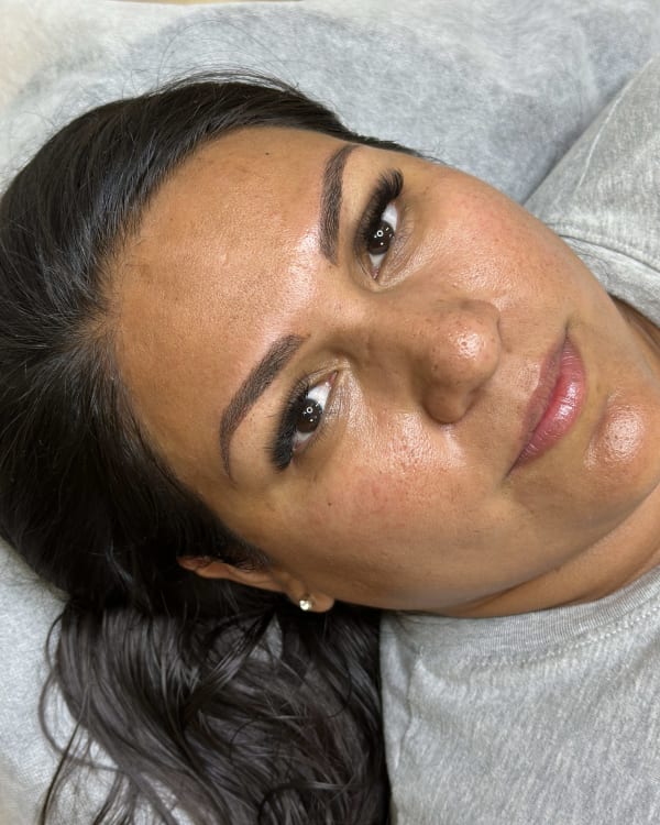 After microblading - Bolingbrook client