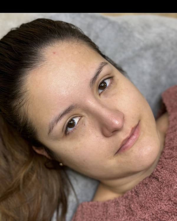 Before microblading - Barrington client