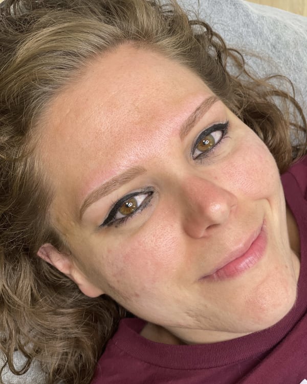 After microblading - No eyebrow hair transformation