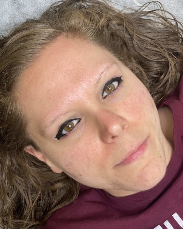 Before microblading - No eyebrow hair transformation