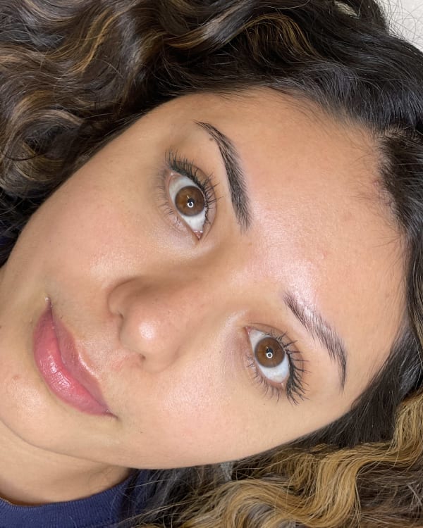Before microblading - Scar transformation