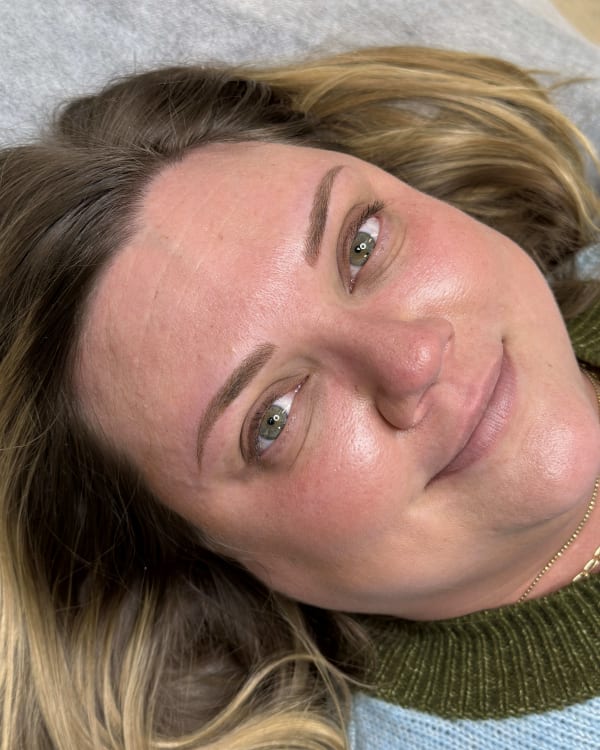 After microblading - White transformation