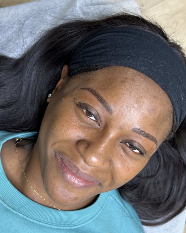After microblading - Plainfield client