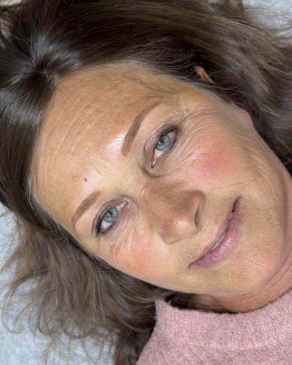 After microblading - Mature transformation