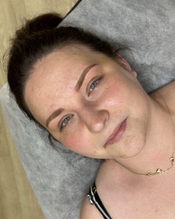After microblading - Yorkville client