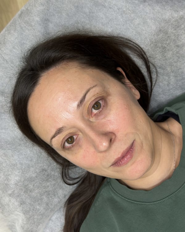 Before microblading - White transformation
