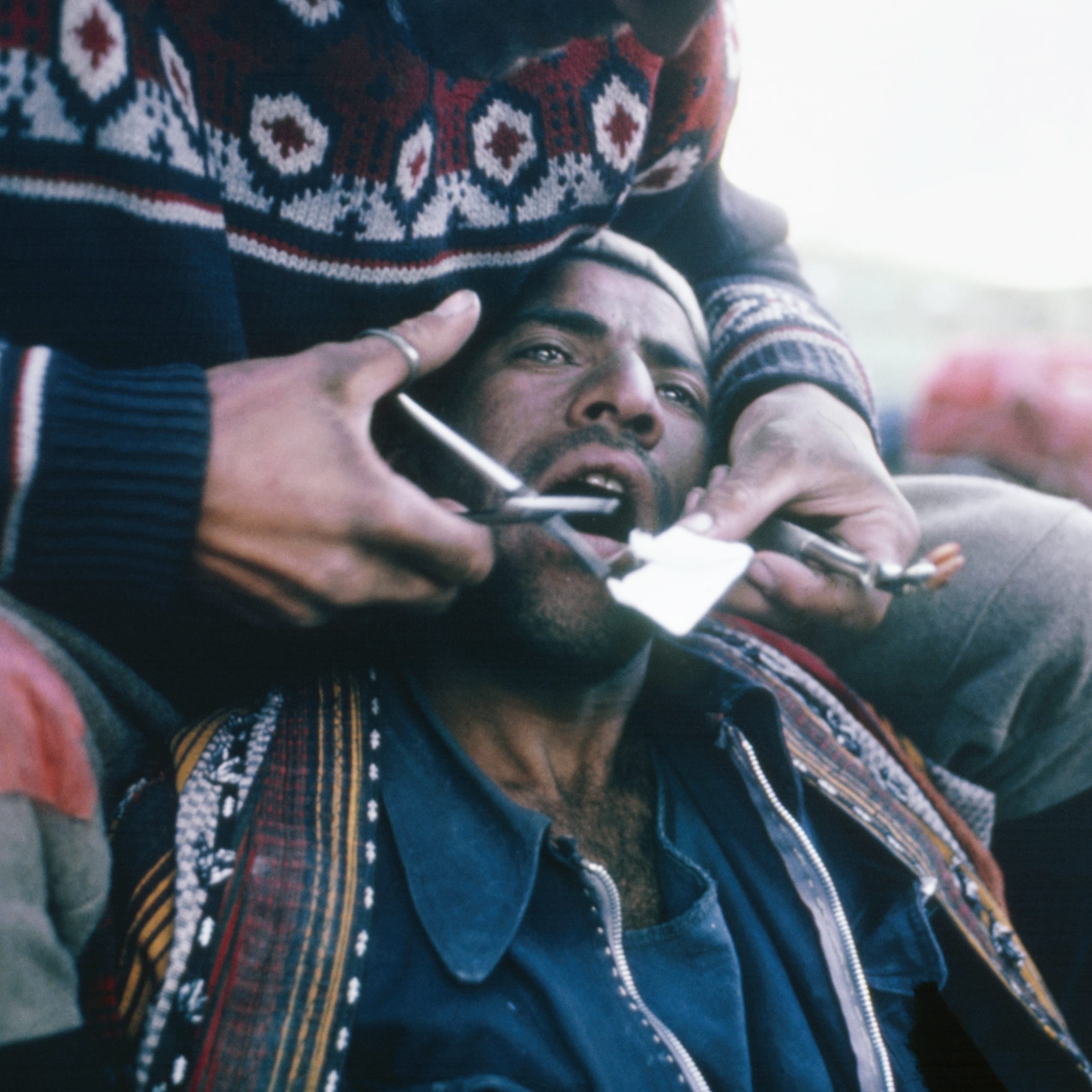 A man is having a tooth pulled with a pair of pliers. The person holding the pliers is out of focus.