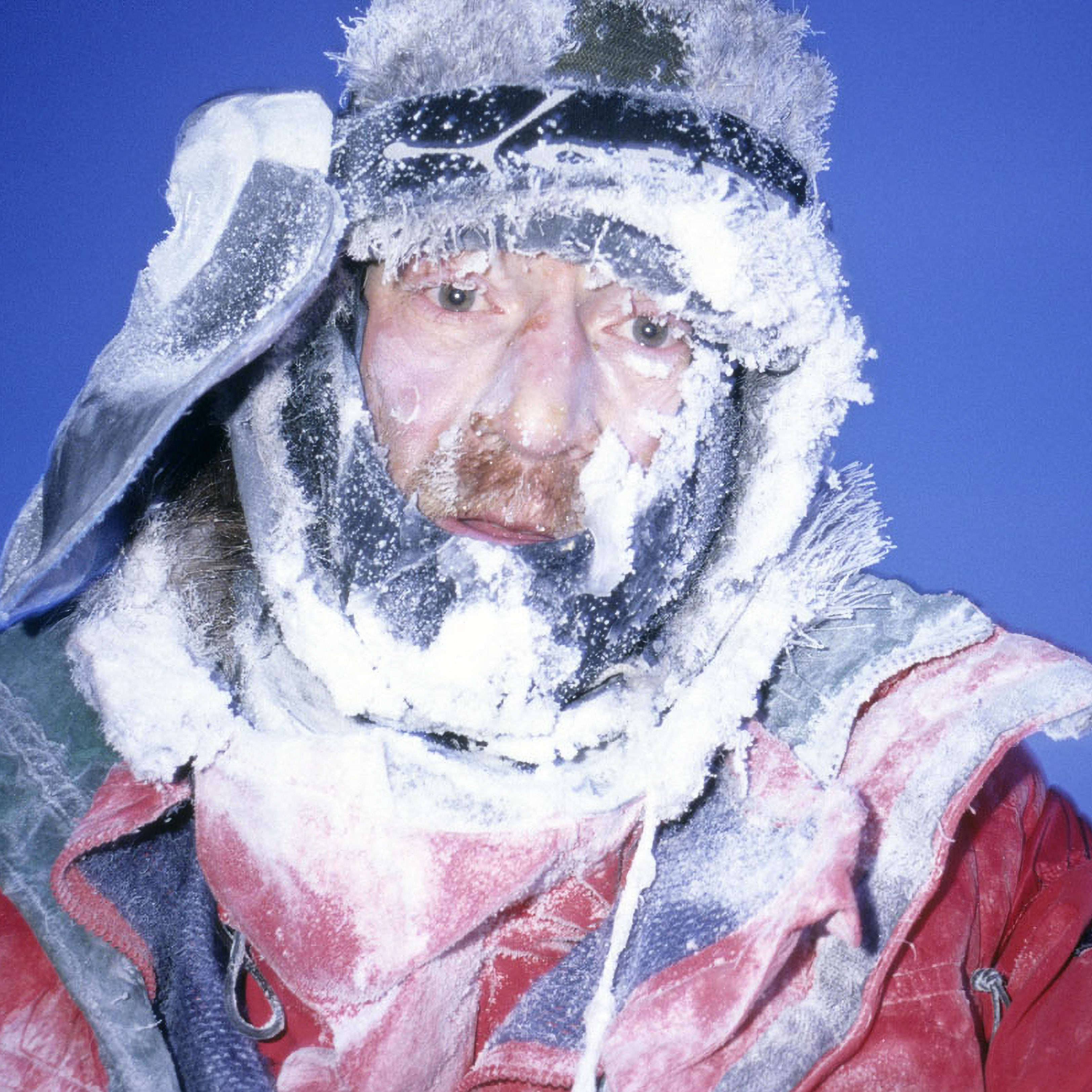 A close up of a person's face covered in frost and ice. They are wearing a red jacket and have a hat pulled down over their head. The background is a solid blue sky. The person appears to be very cold.