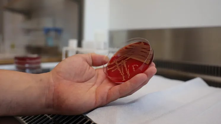 Fler provsvar blir synliga i journalen på 1177.se – nu även mikrobiologi