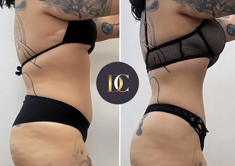 Dermani Clinic Motala AB i konkurs efter laserbehandling