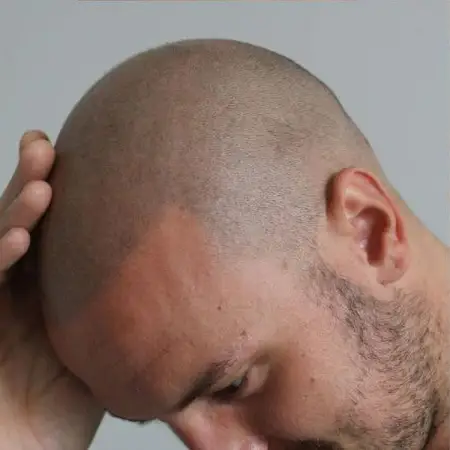 Hair Tattoo After