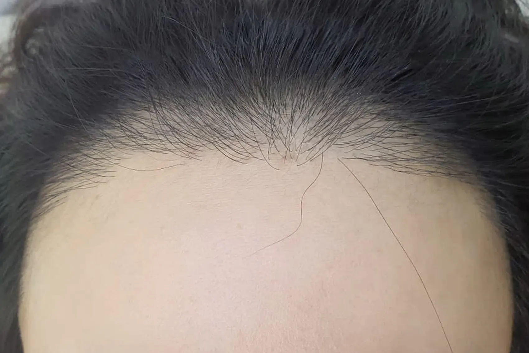 Why Korean Women Are Microblading Their Hairlines