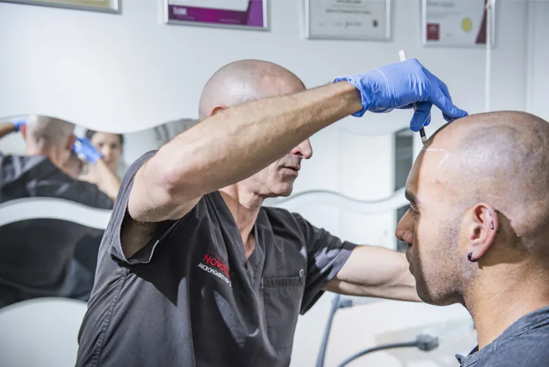 SMP Technician Applying Tattoo Outline