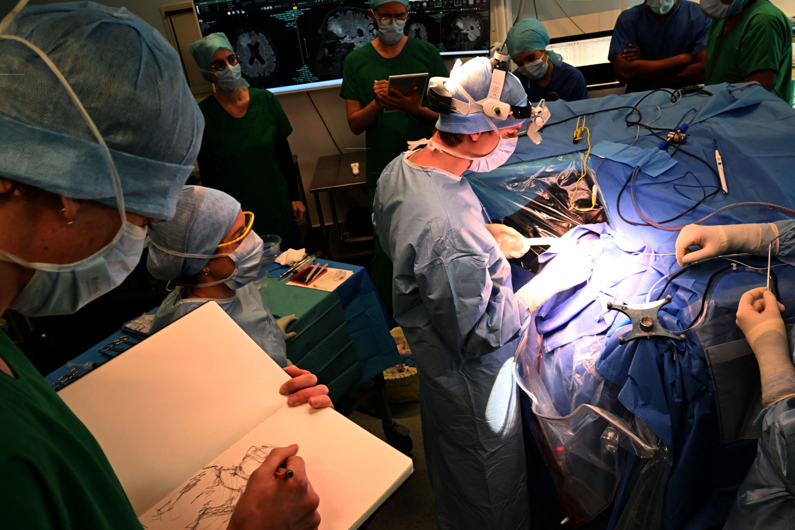 AI Restores Sight in World-First Live Brain Surgery Using Real-Time Video